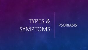 Pso Types and Symptoms